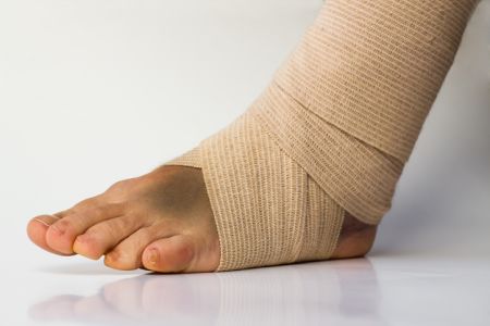 Medical bandage correctly wrapped around female sprained left ankle stand on white background